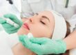 Microneedling procedure at Vishka Skincare