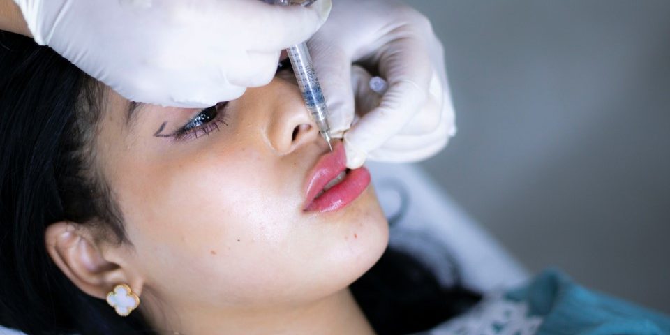 lips-fillers-at-vishka-skin-care-youssef-labib-eX9nOyALjg4-unsplash Lip fillers treatment at vishka skincare