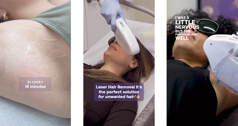 Laser Hair Removal Feature Image Three Different Sessions 15 minutes