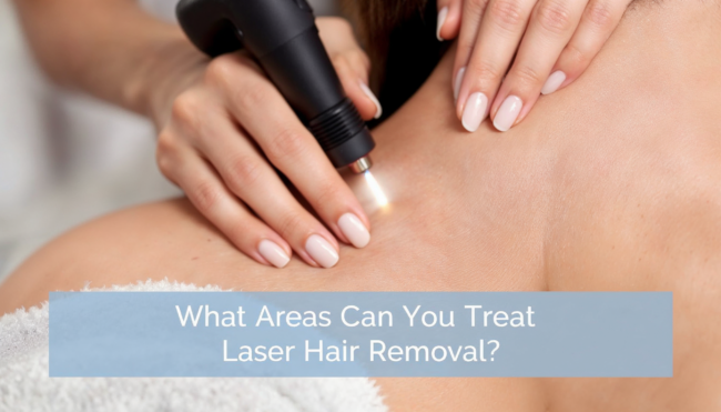What Areas Can You Treat with Laser Hair Removal
