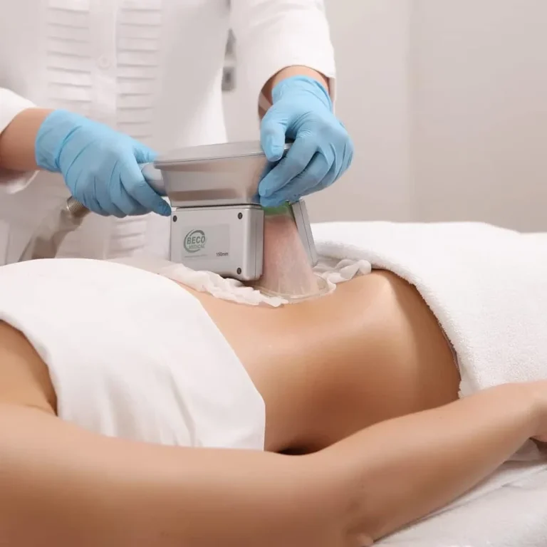 fat freezing-lipo laser