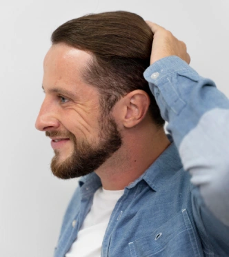 hair-restoration-img12
